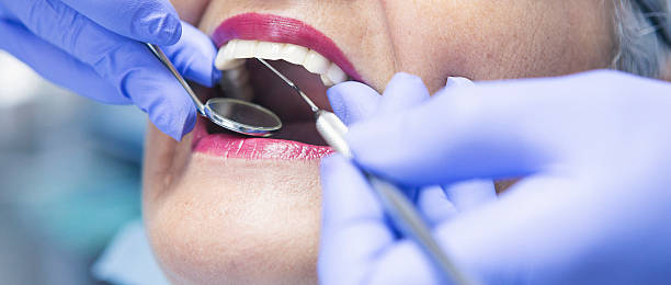 Best Emergency Tooth Extraction in West Hammond, NM